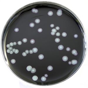 Legionella BCYE Medium/TSA with Sheep Blood